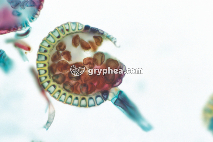 Sporange de Fougère (Pteridium) x70 - gryphea.org